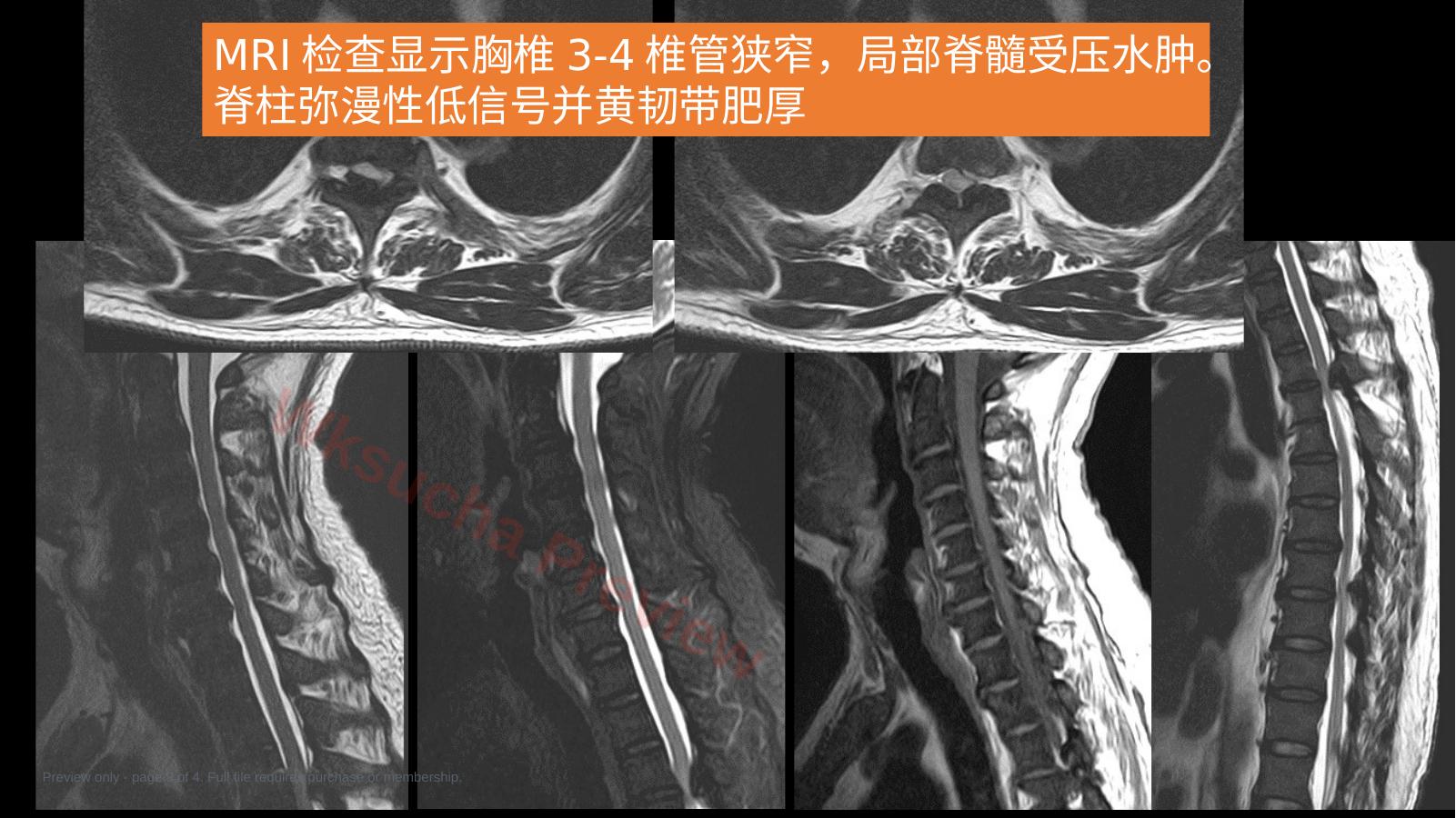 预览第 3 页