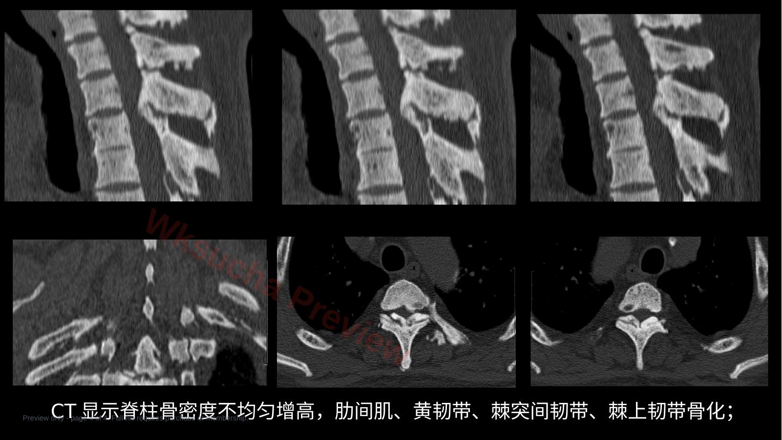 预览第 4 页