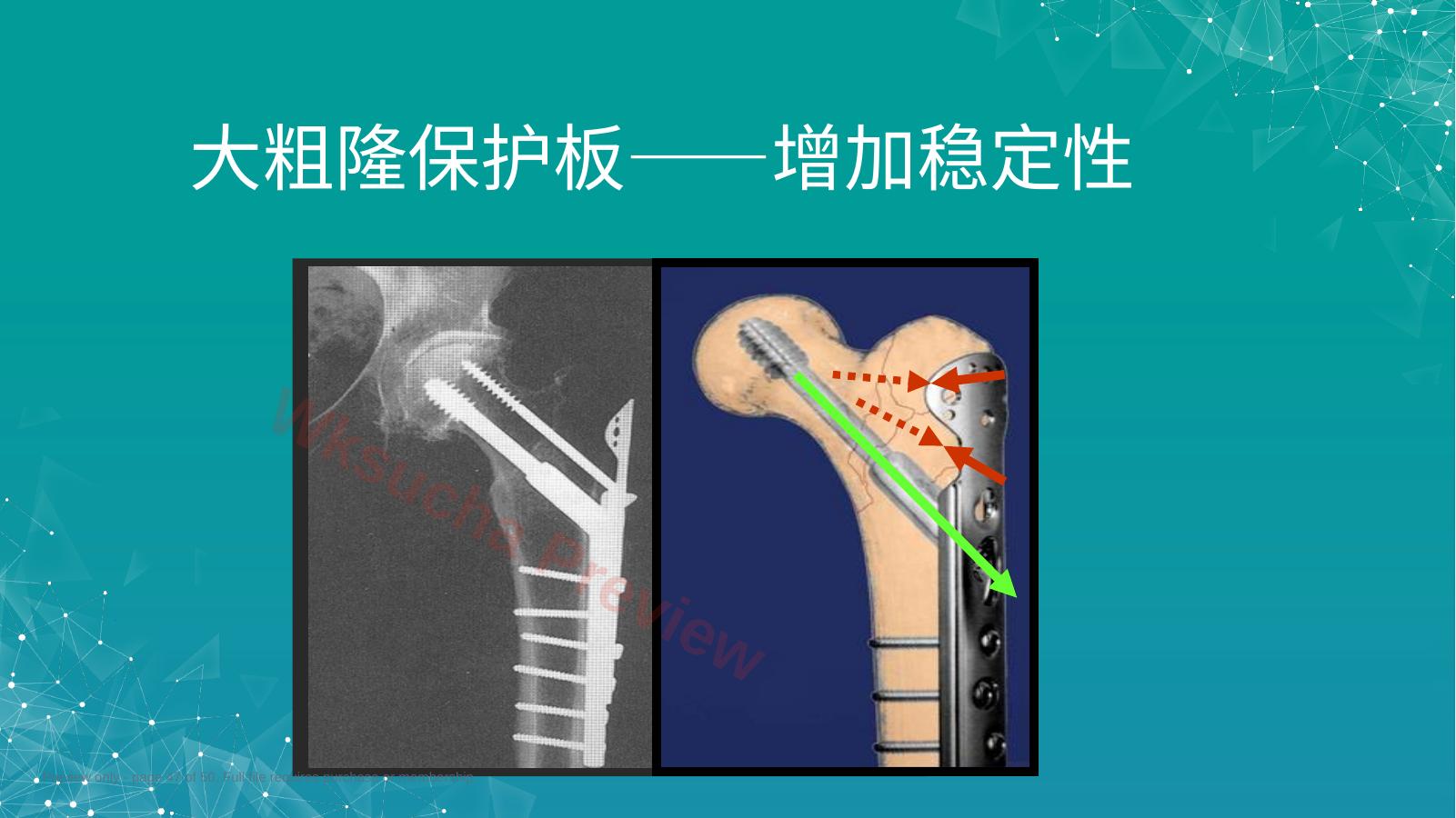 预览第 47 页