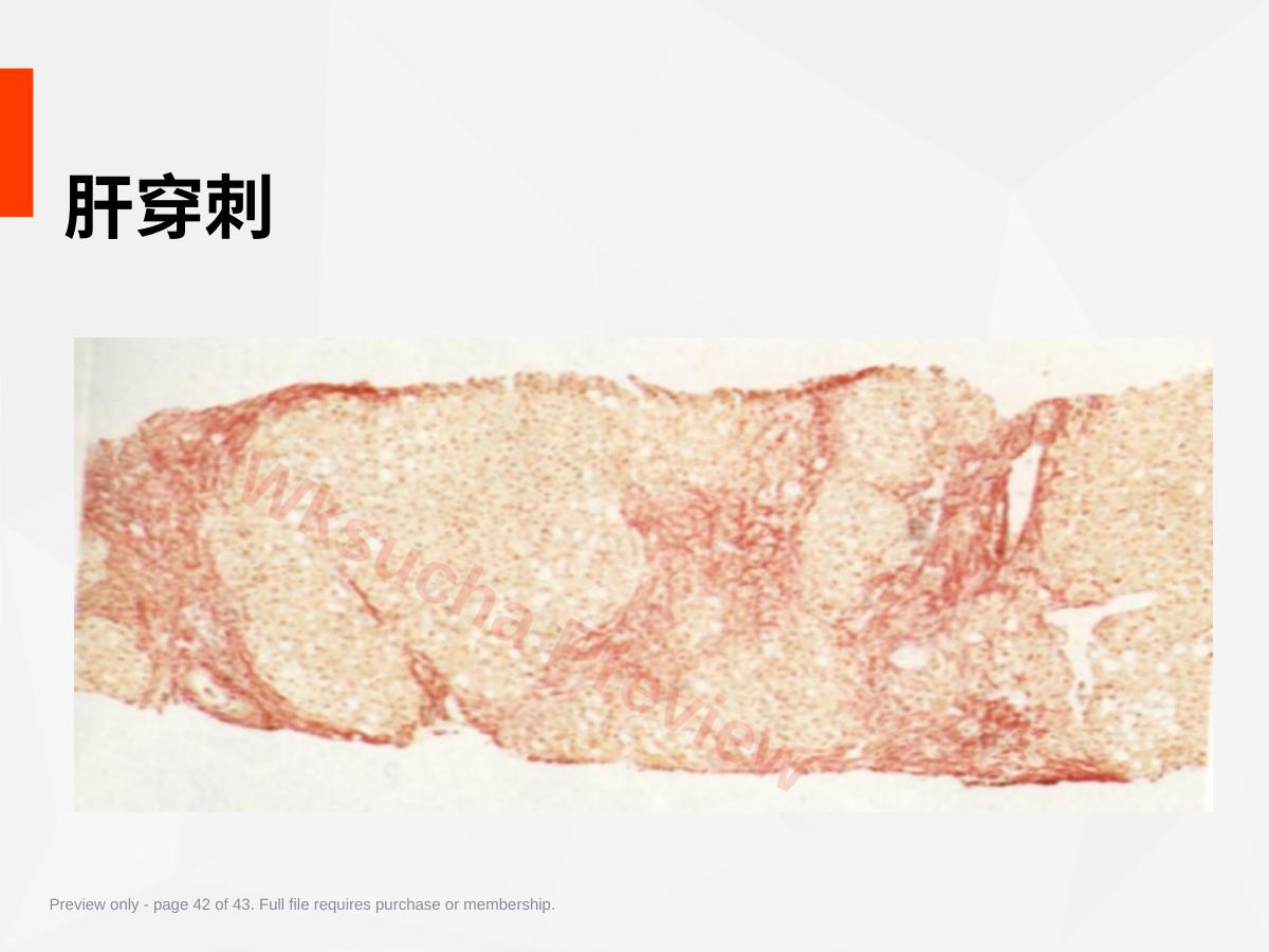 预览第 42 页