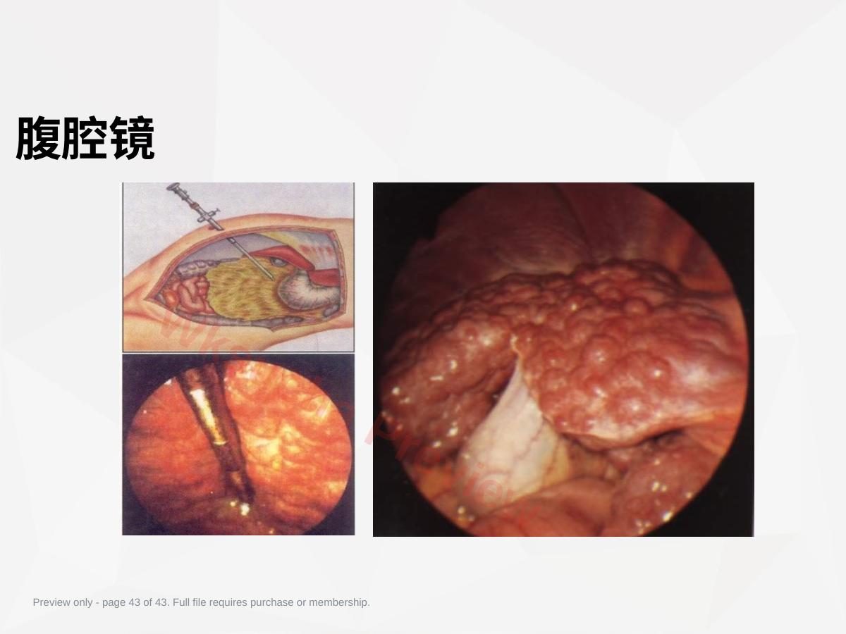 预览第 43 页