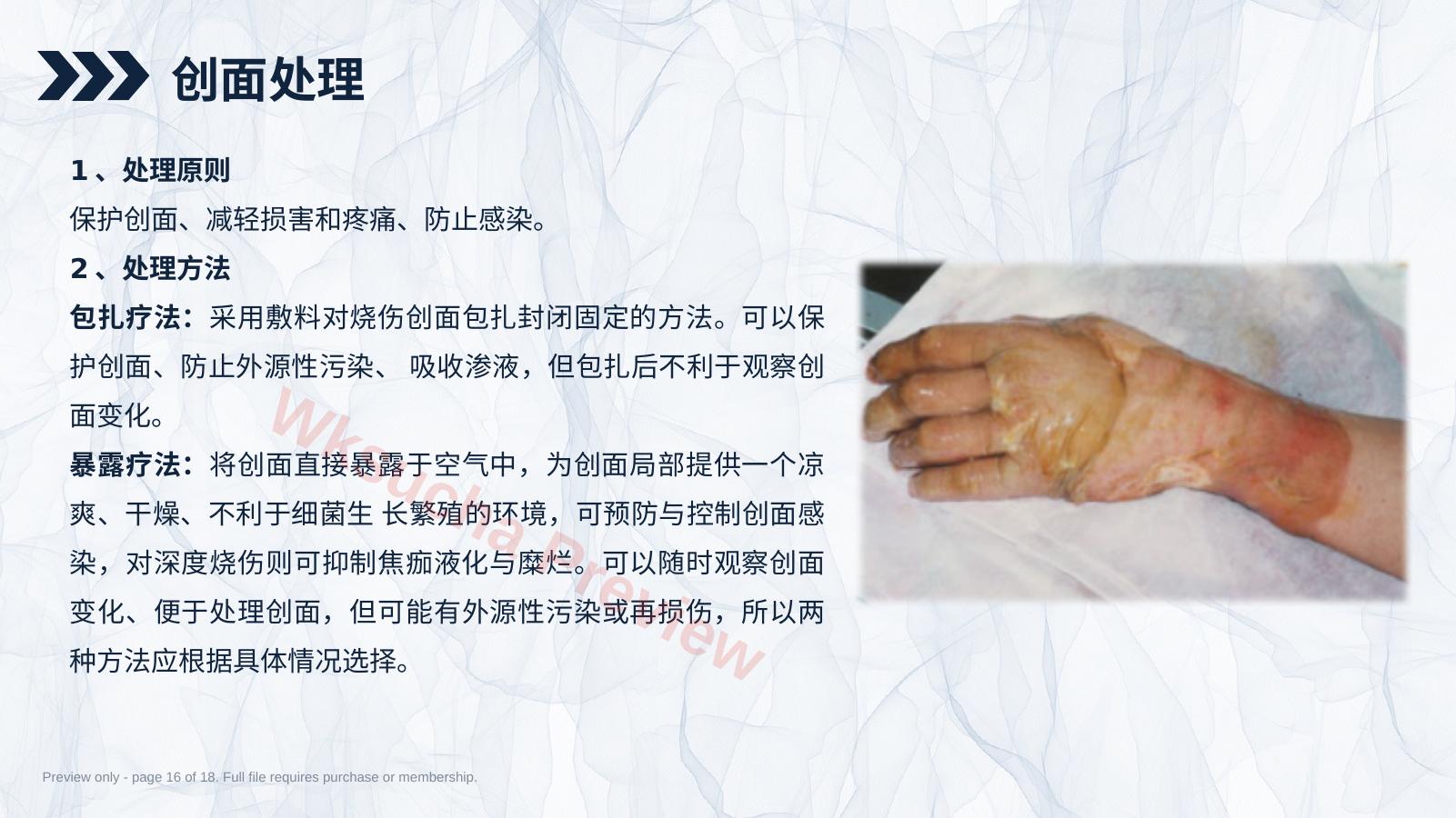 预览第 16 页