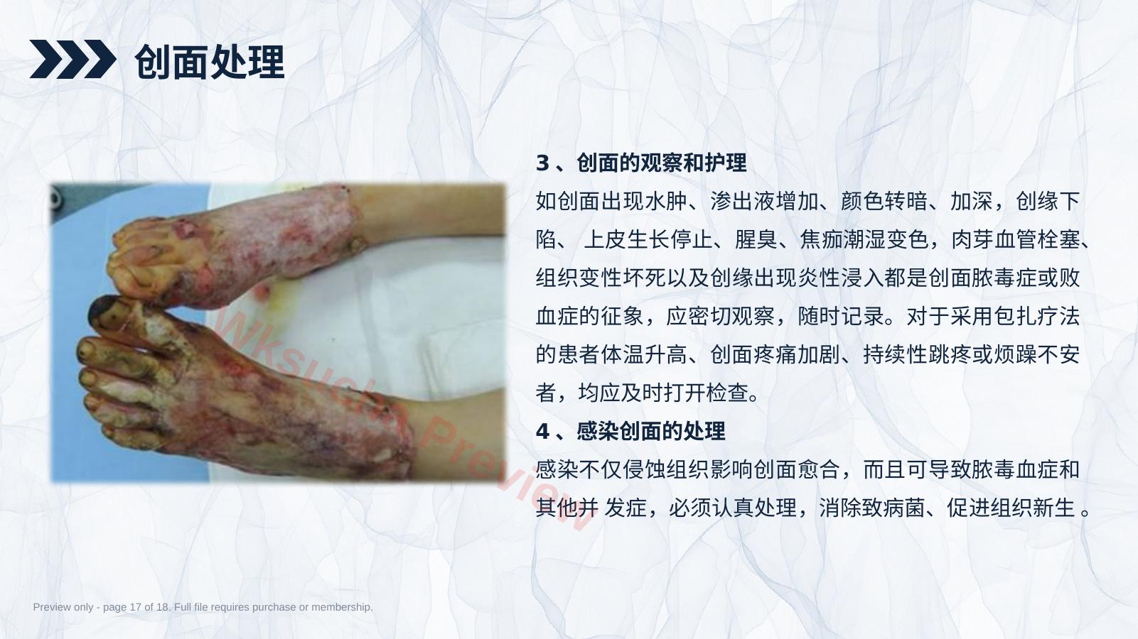 预览第 17 页