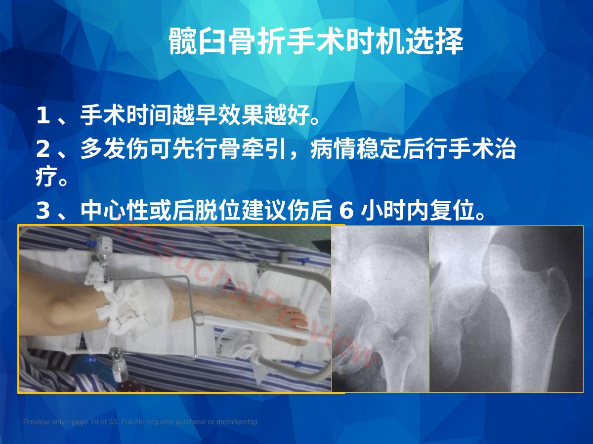 预览第 18 页
