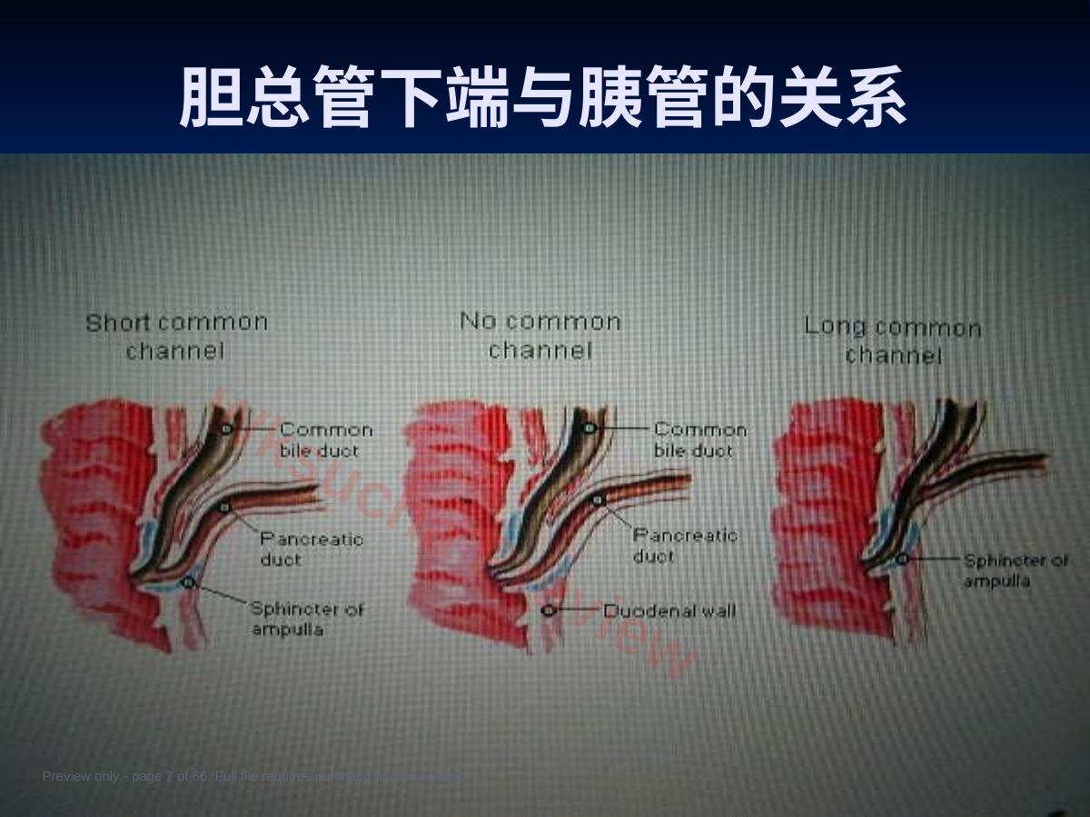 预览第 7 页