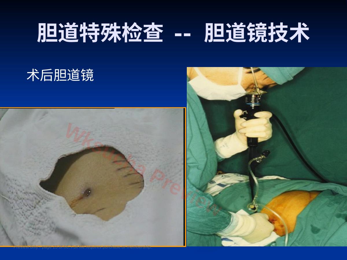预览第 23 页