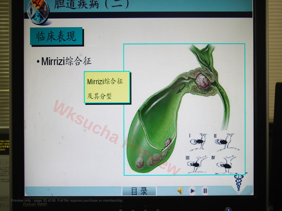 预览第 35 页