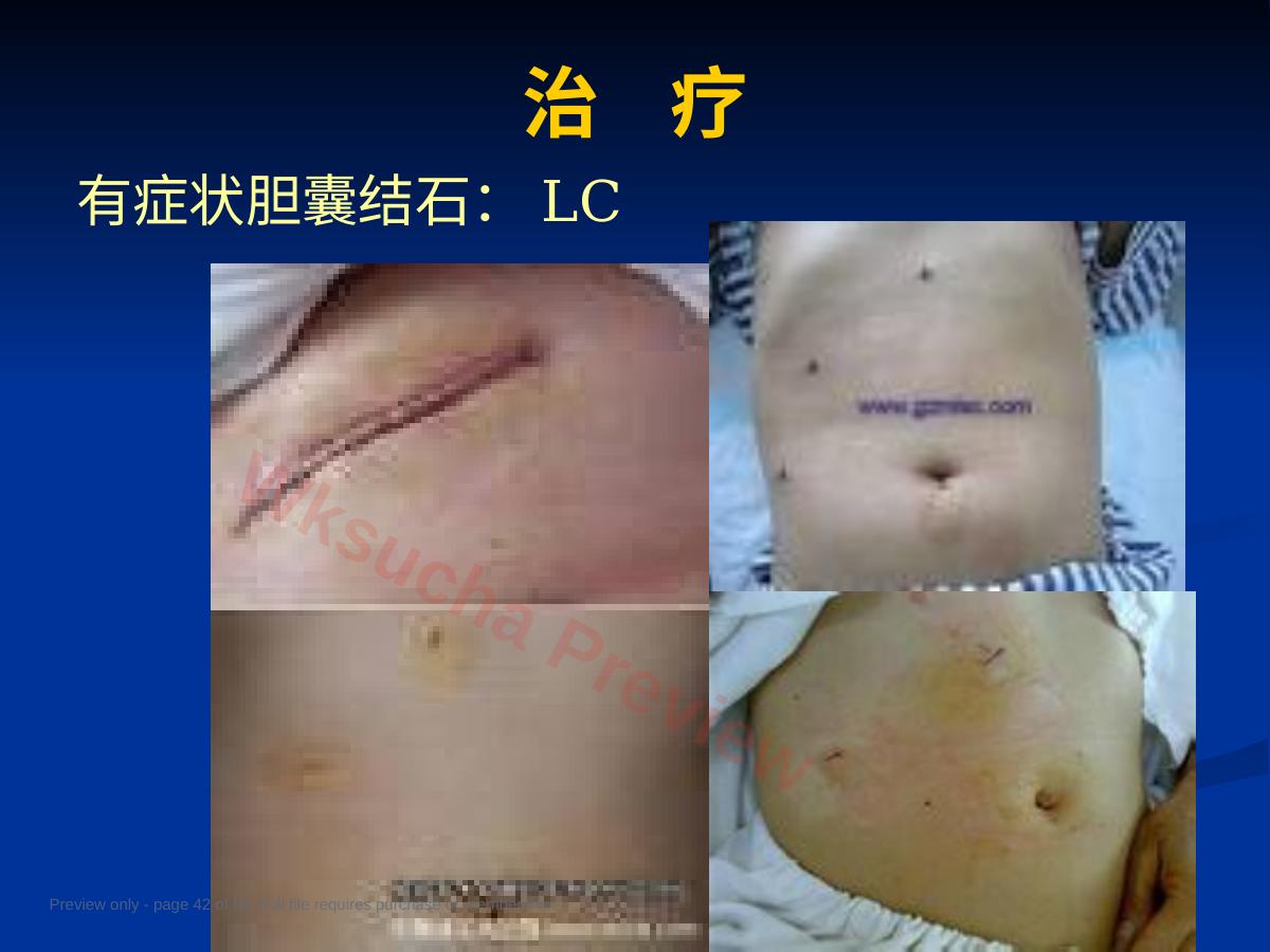 预览第 42 页