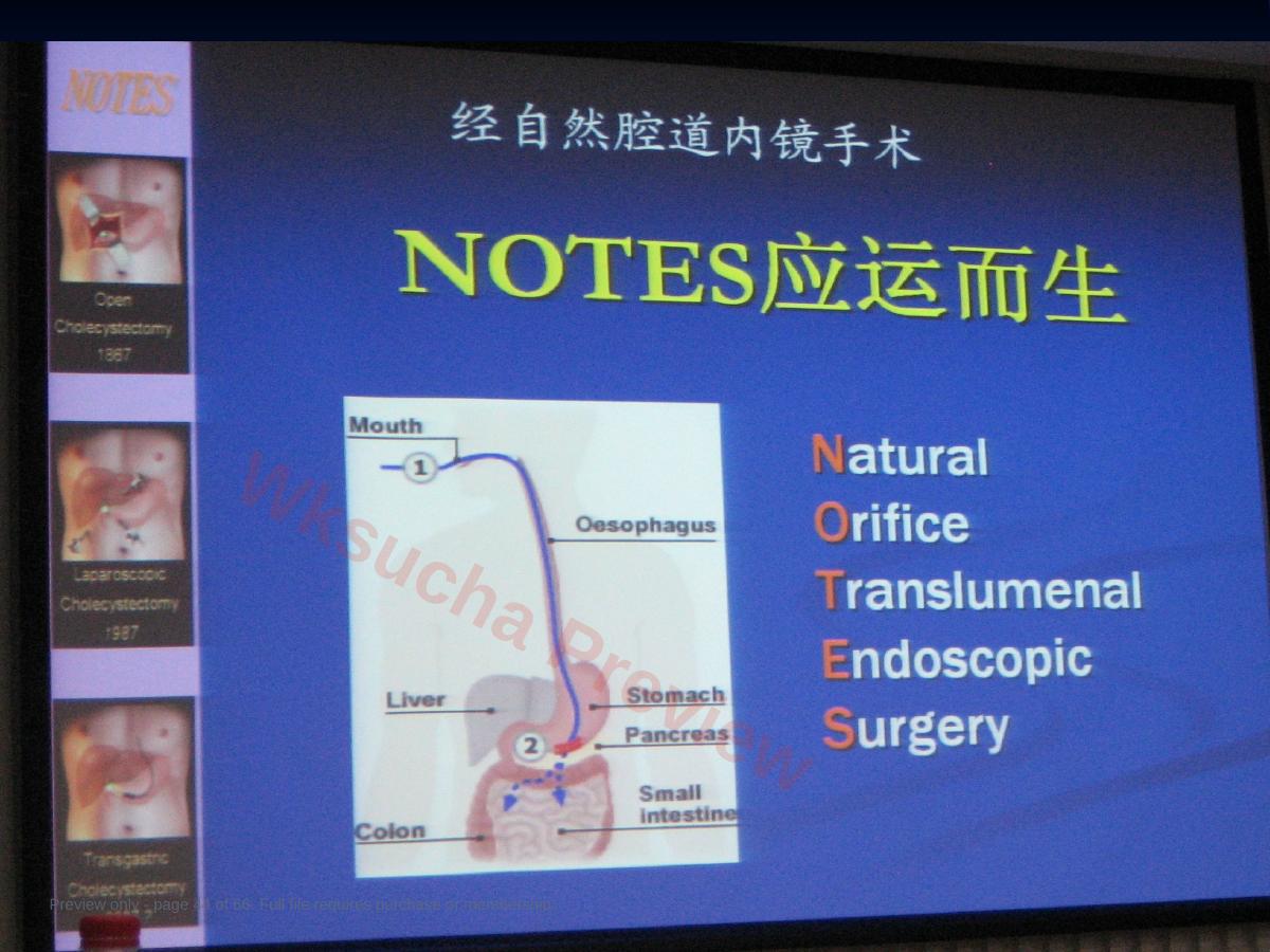 预览第 44 页