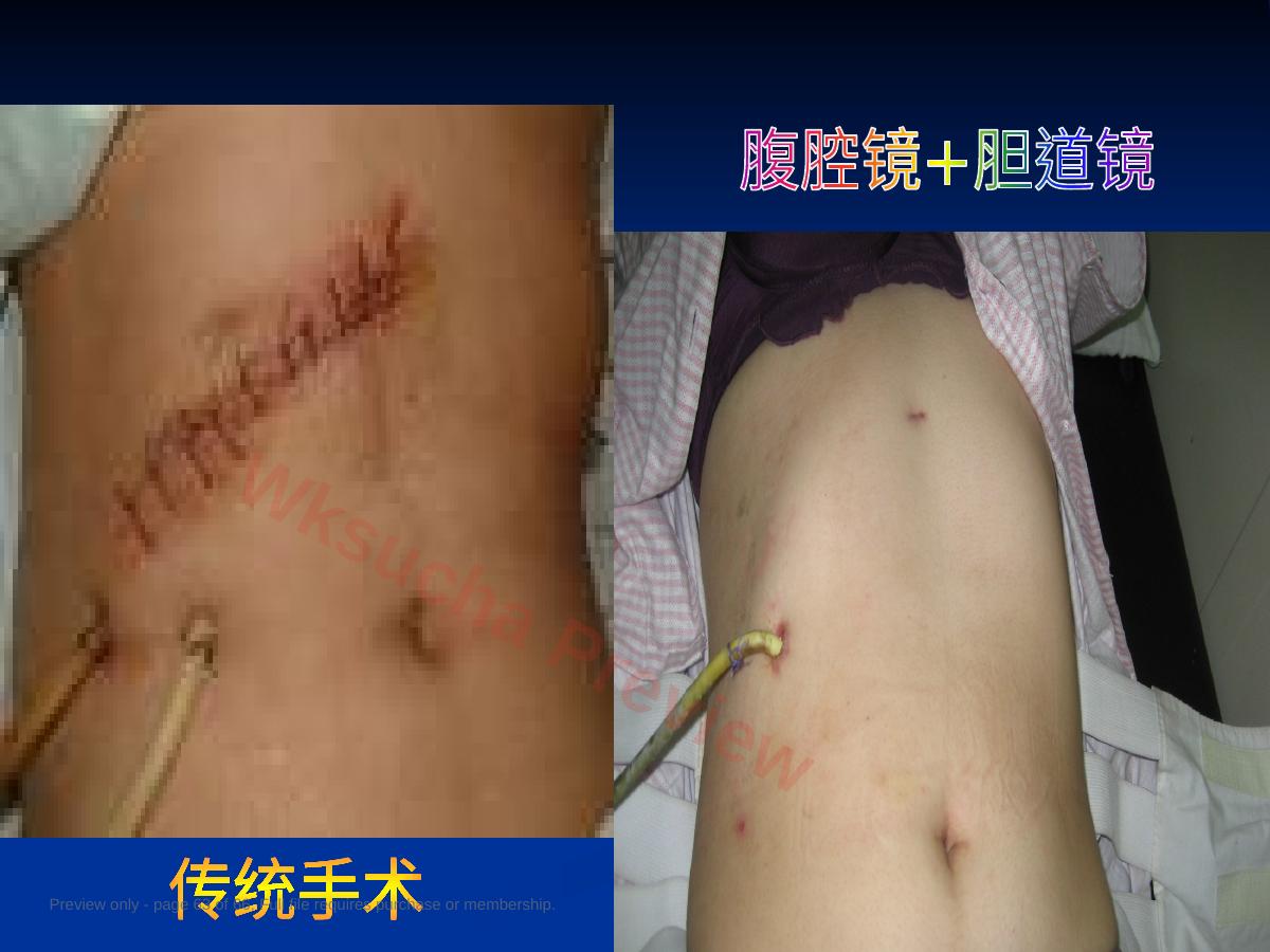 预览第 63 页