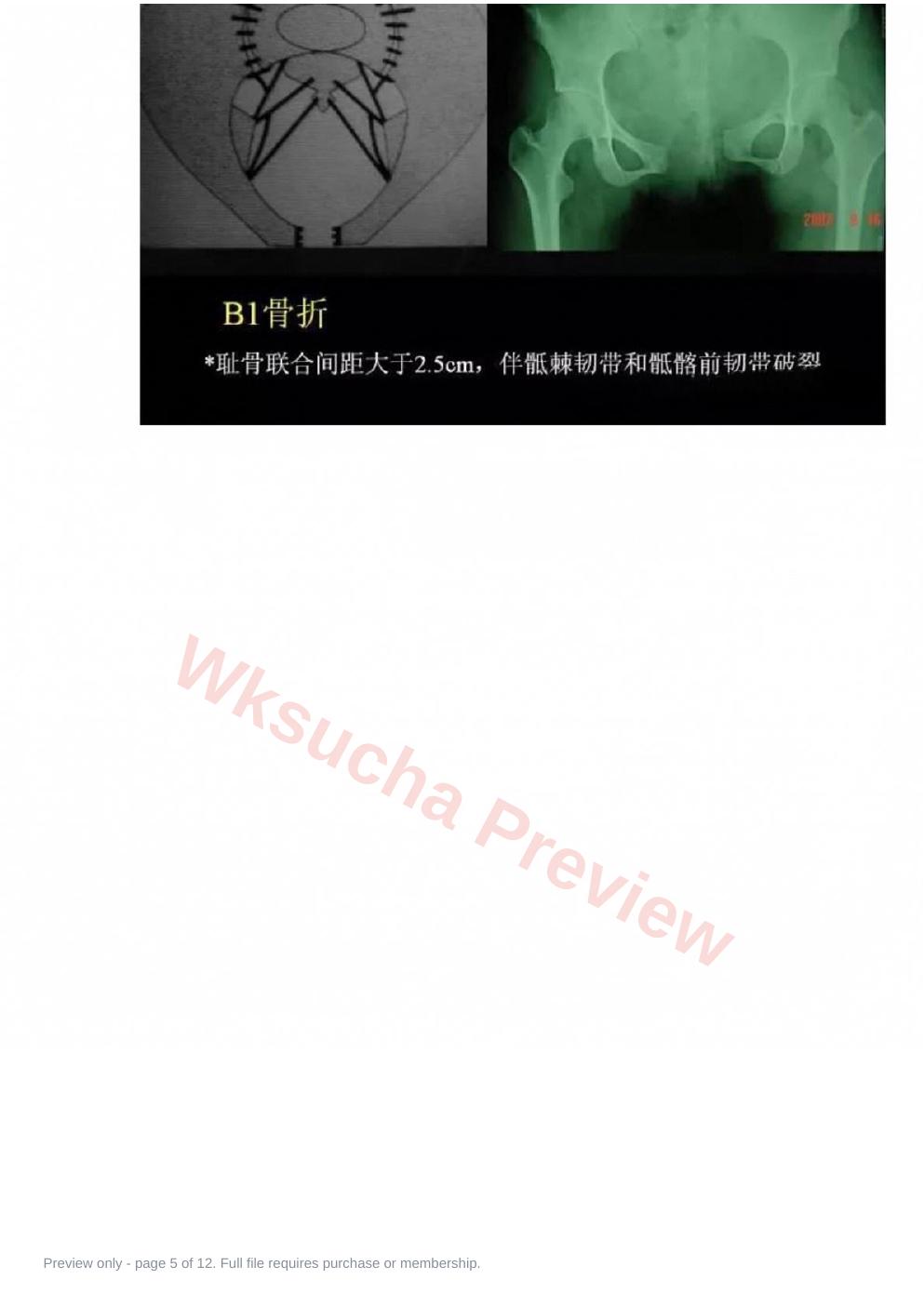 预览第 5 页