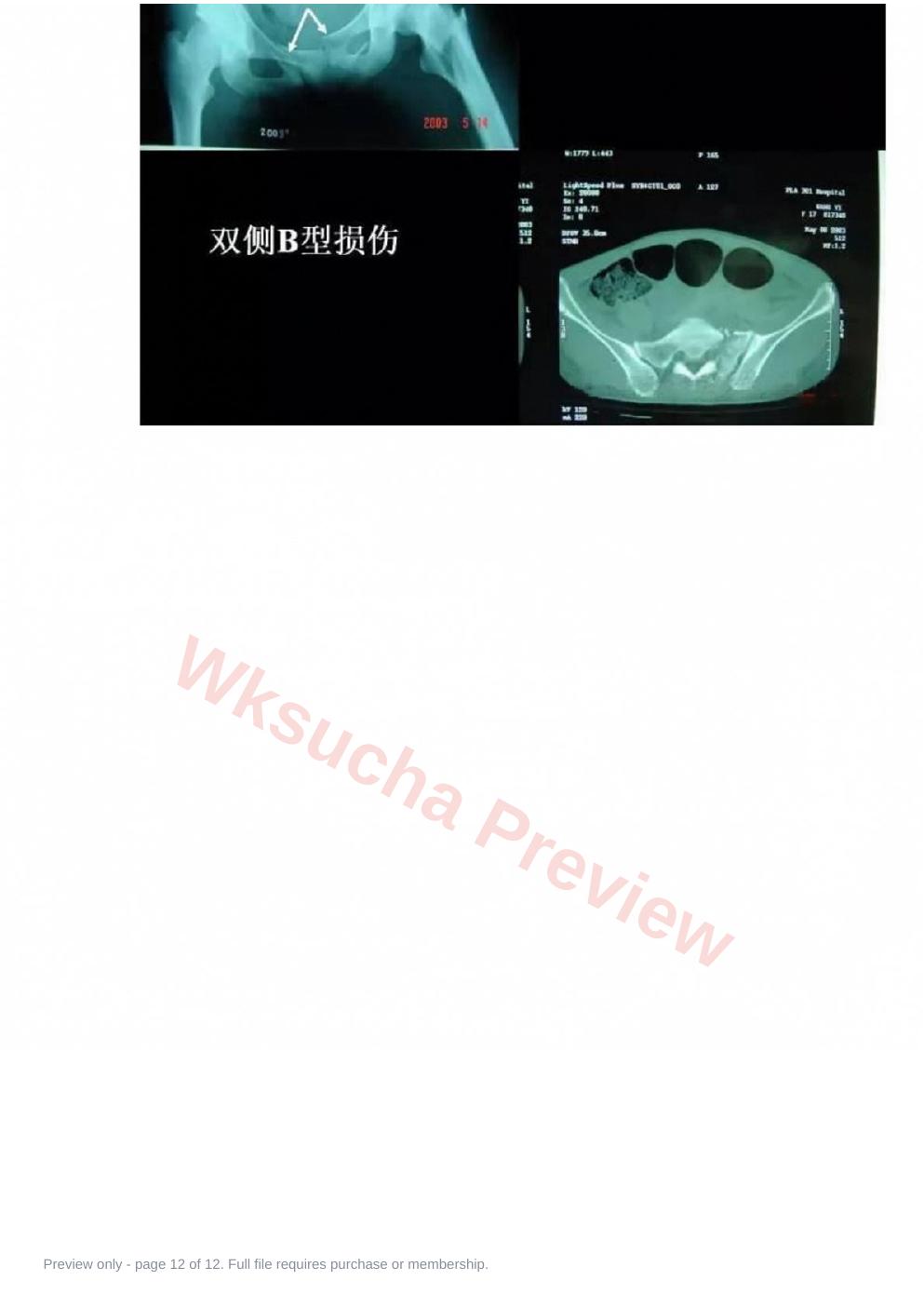 预览第 12 页