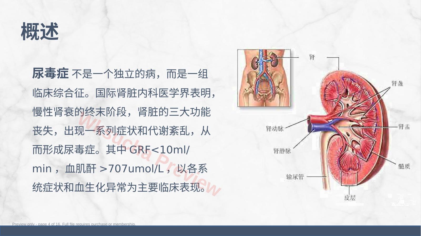 预览第 4 页