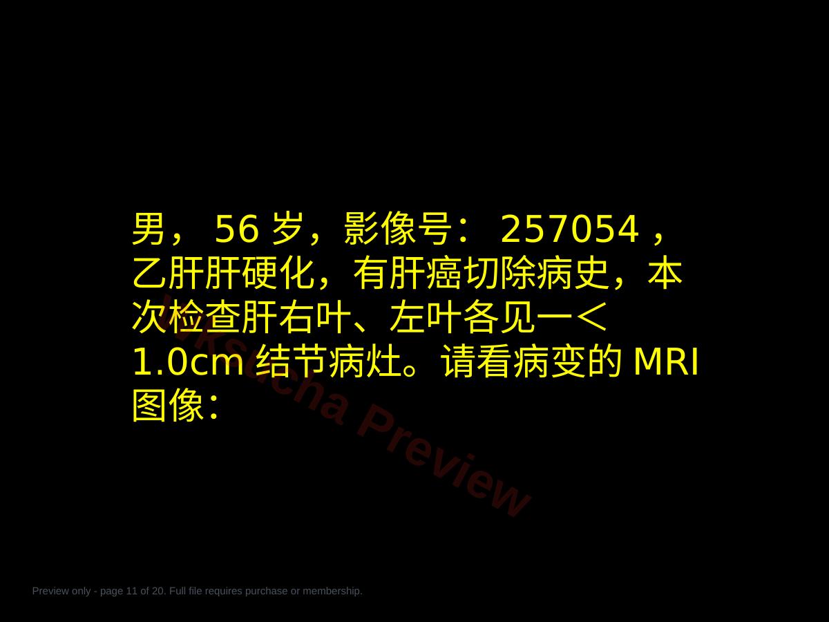 预览第 11 页