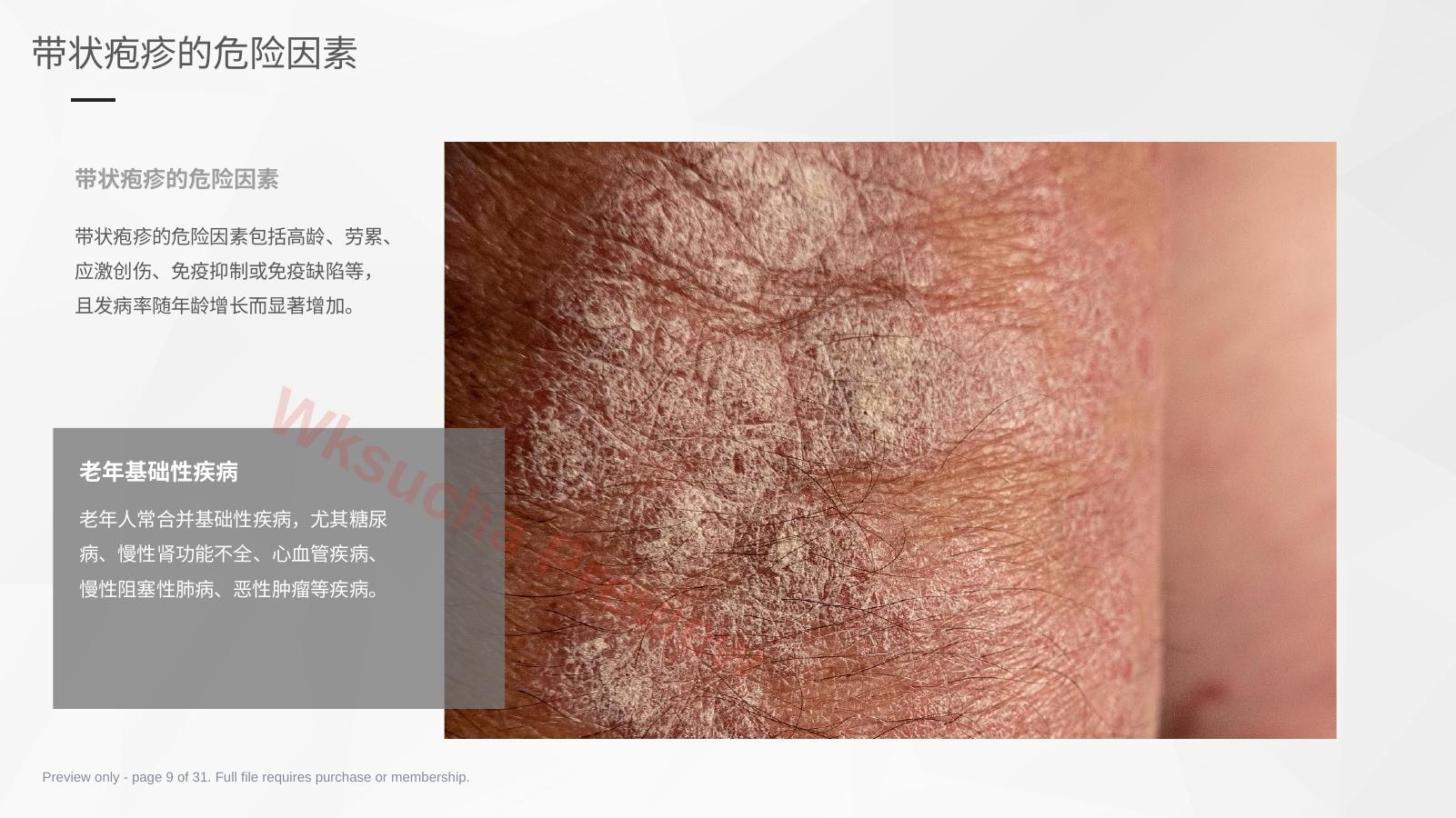 预览第 9 页