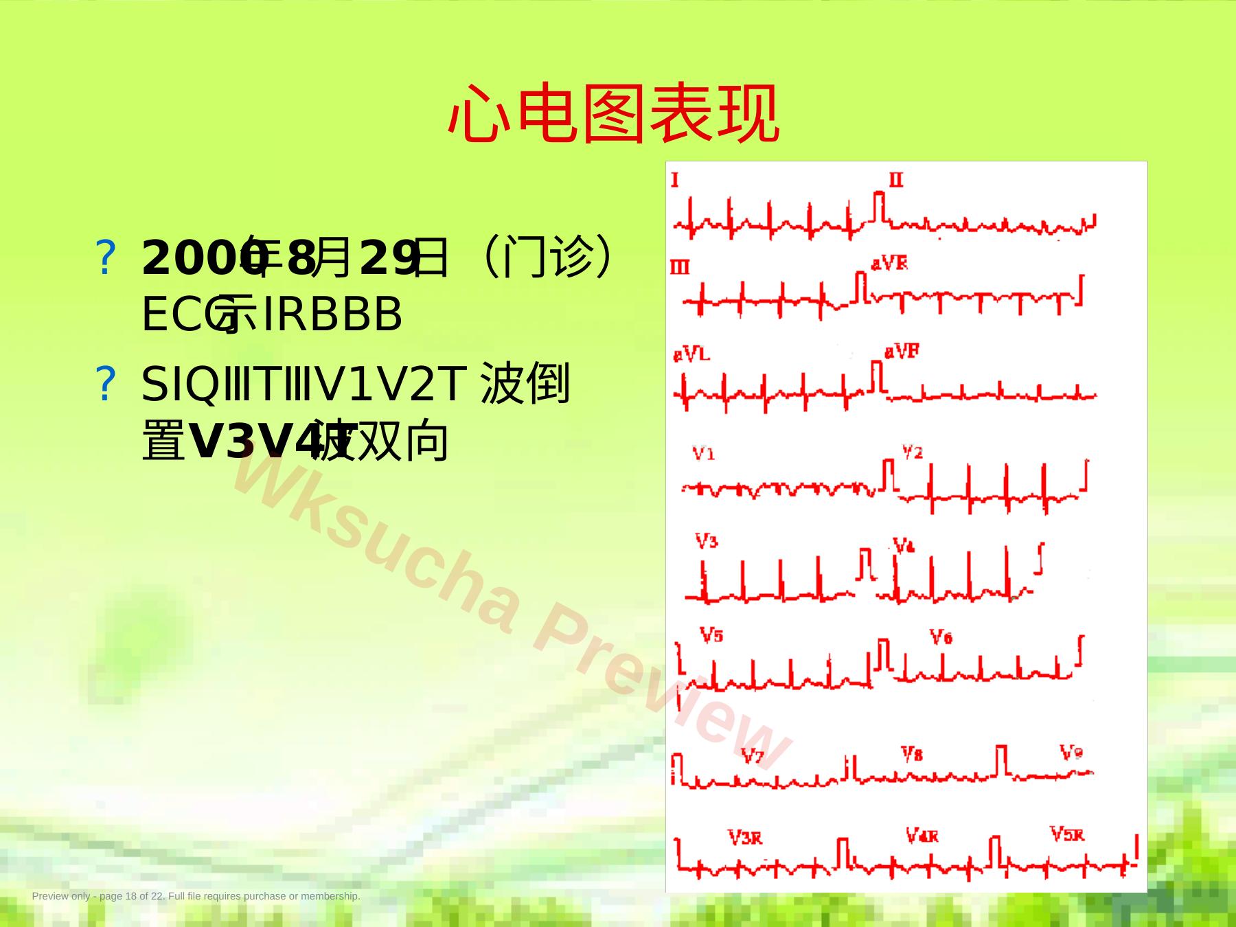 预览第 18 页