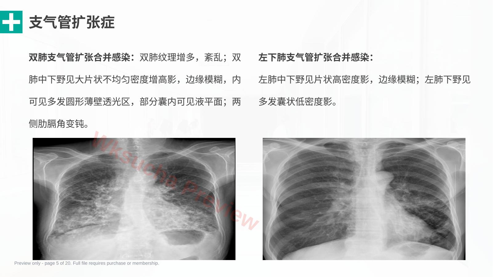预览第 5 页