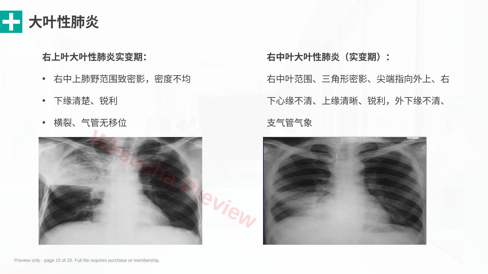 预览第 15 页