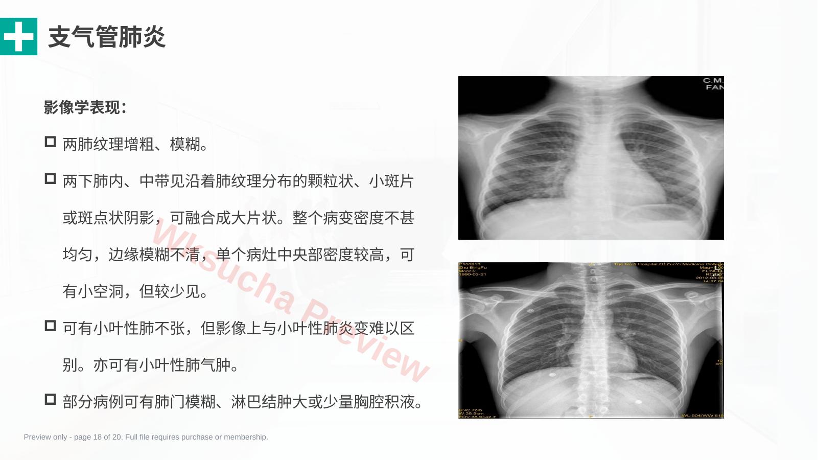 预览第 18 页