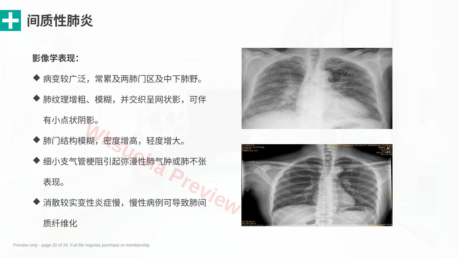 预览第 20 页