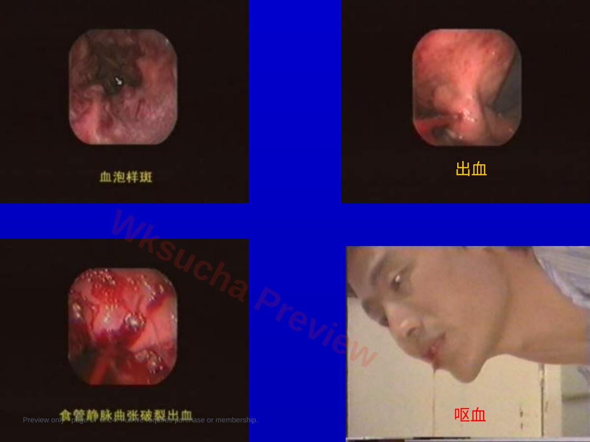 预览第 17 页