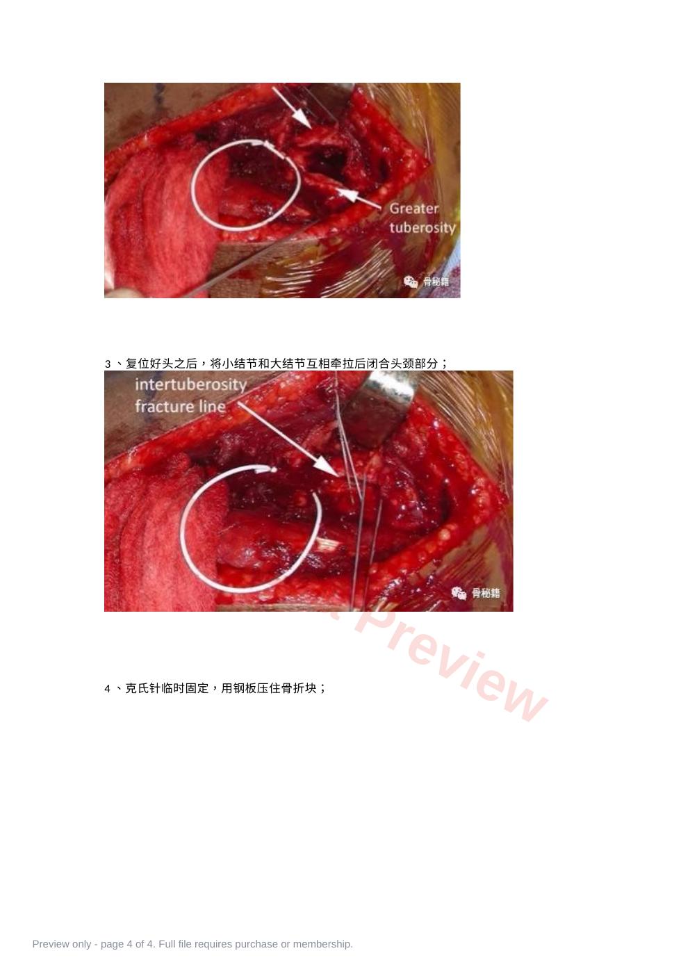 预览第 4 页