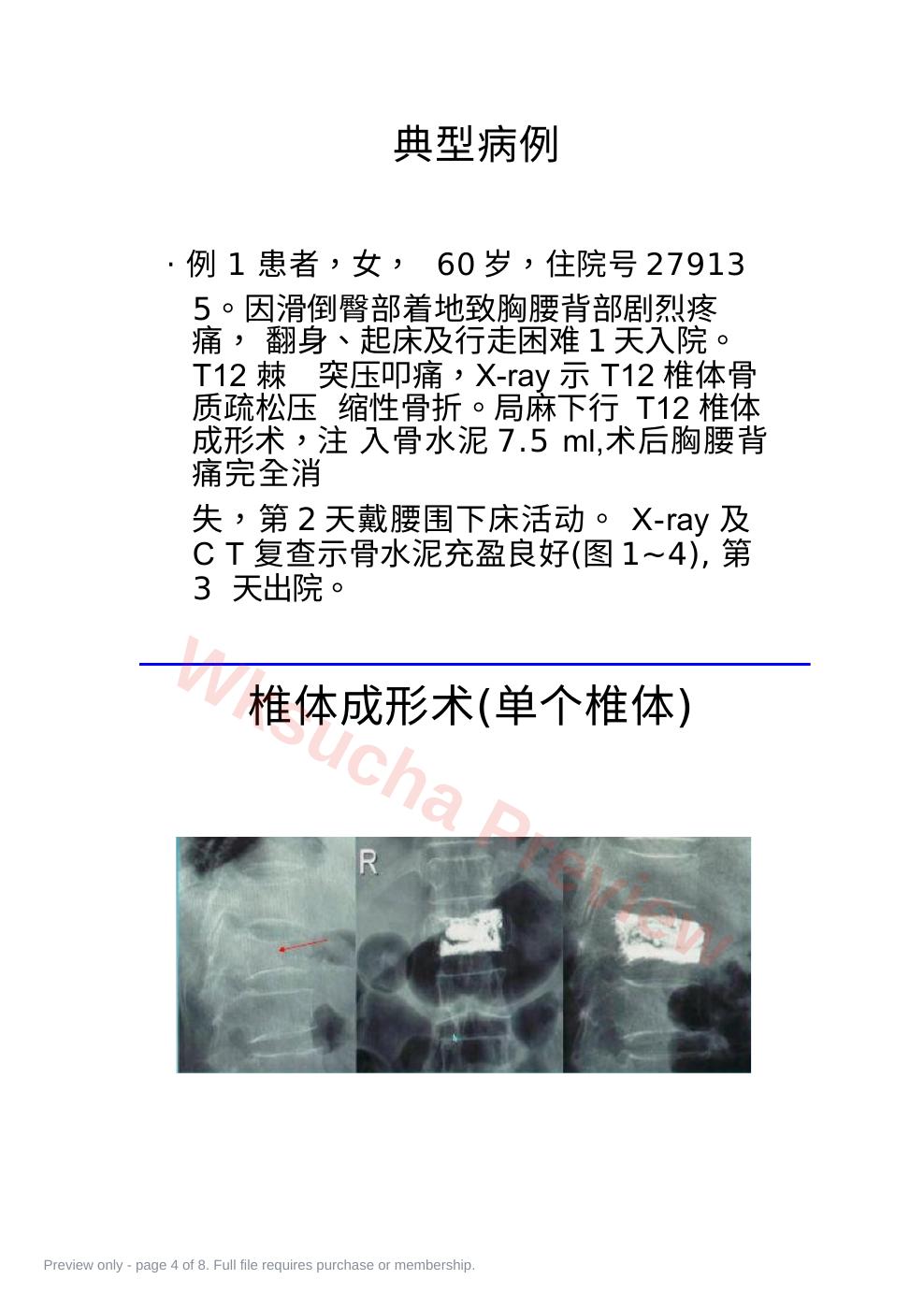 预览第 4 页