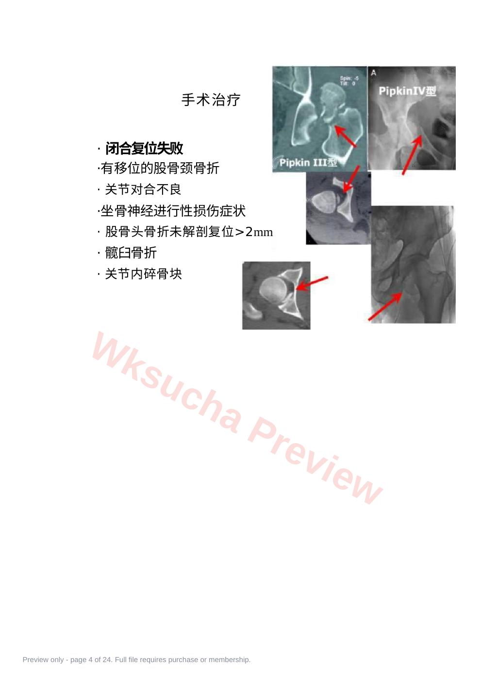 预览第 4 页