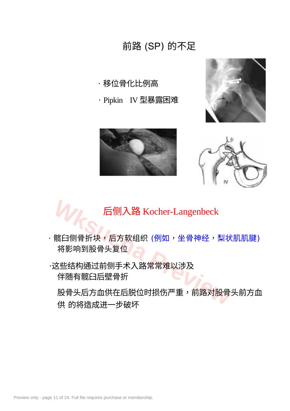 预览第 11 页