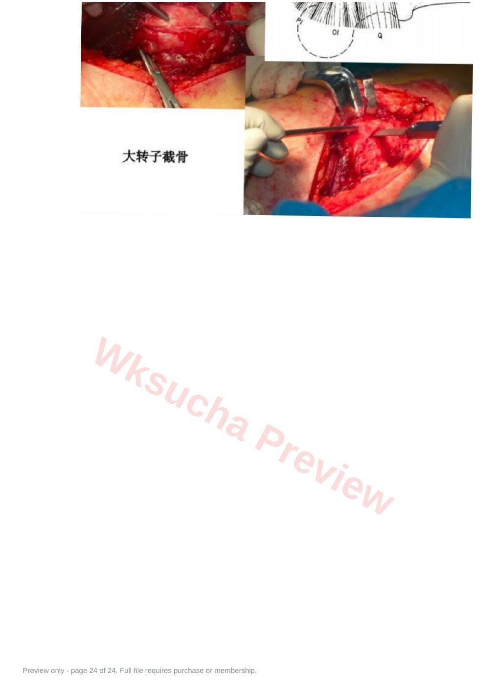 预览第 24 页