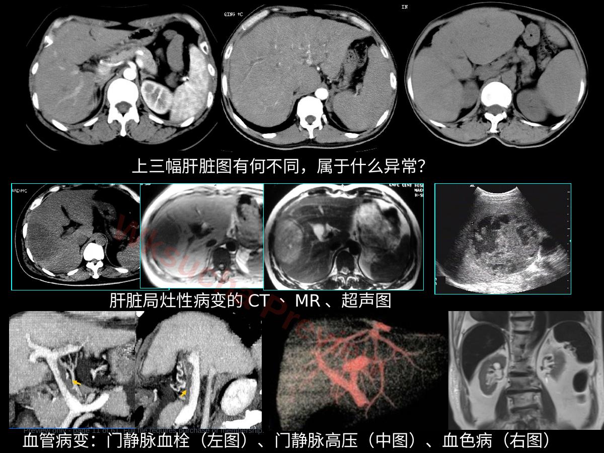 预览第 11 页