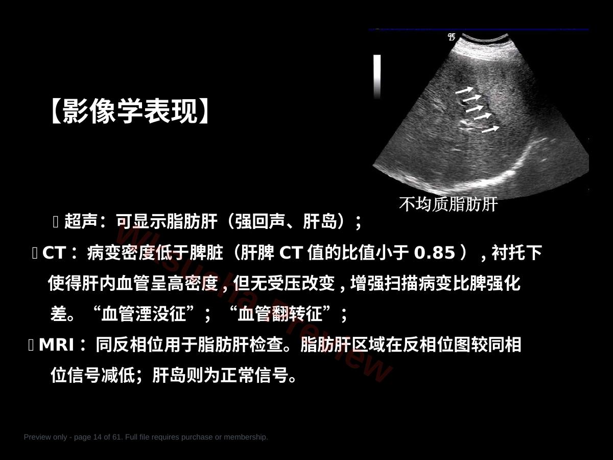 预览第 14 页