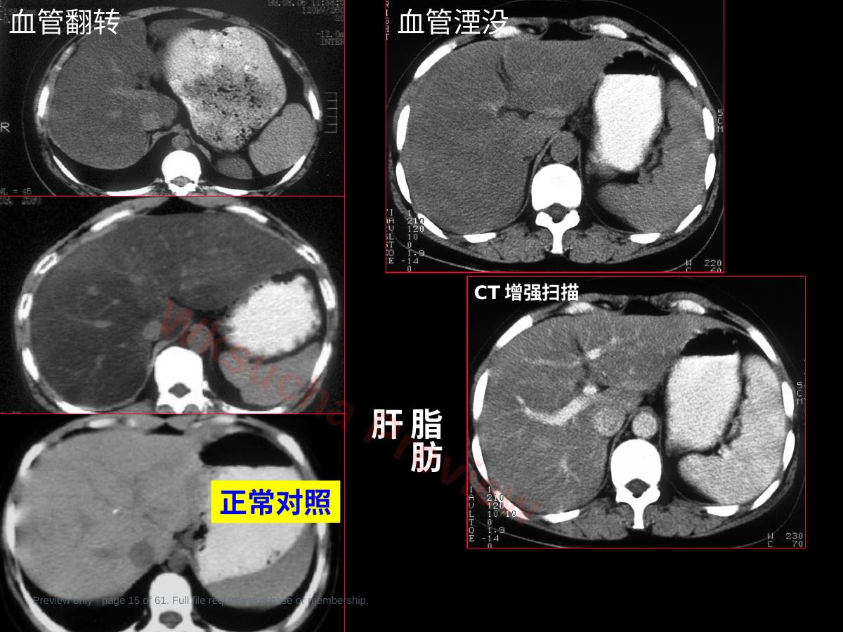 预览第 15 页