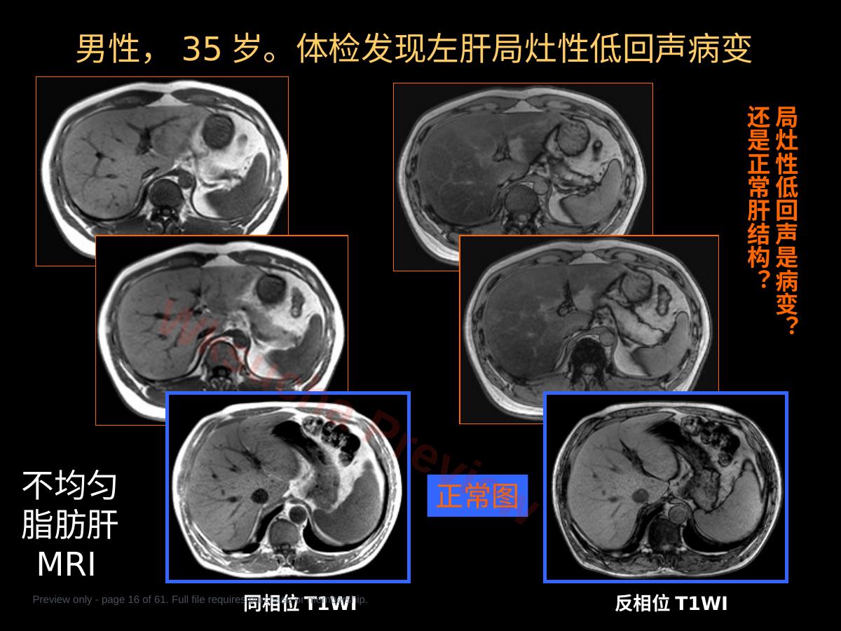 预览第 16 页