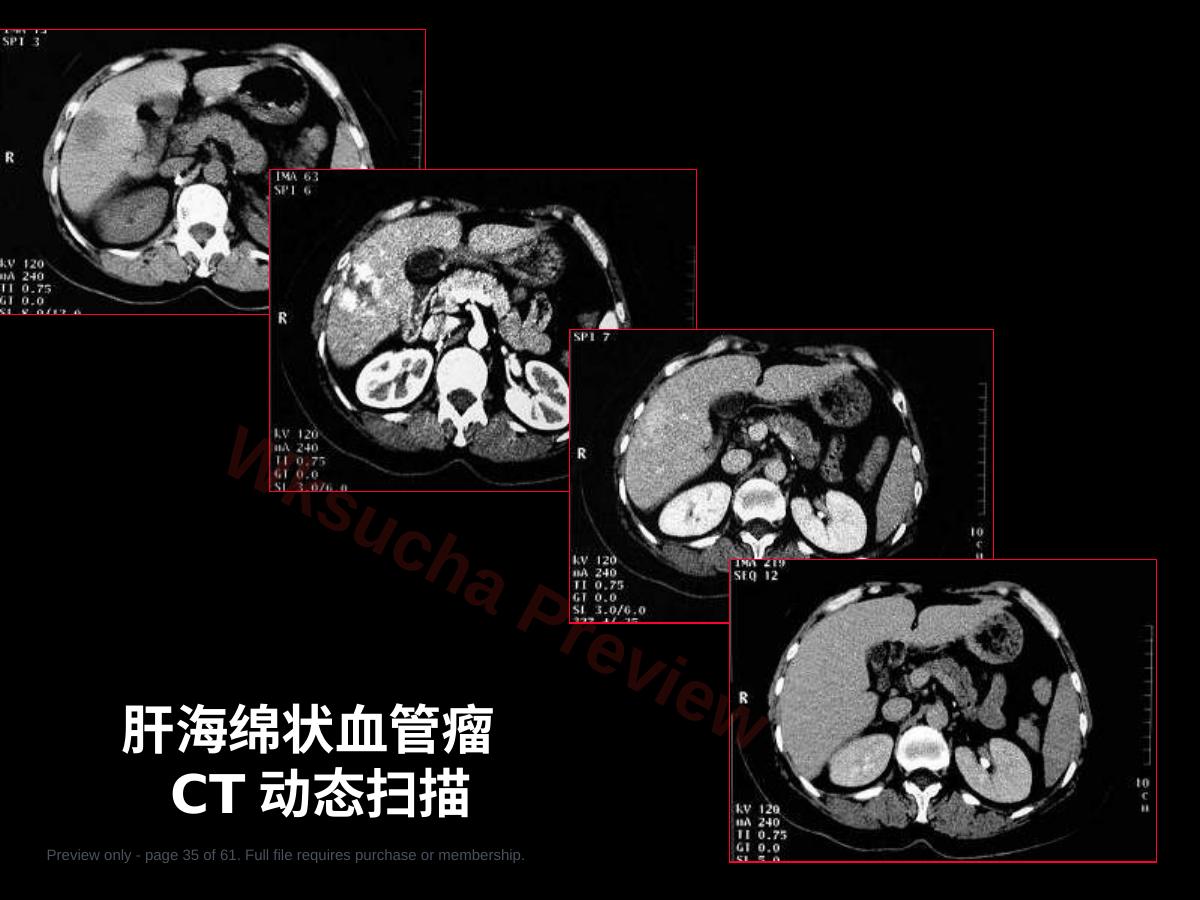 预览第 35 页