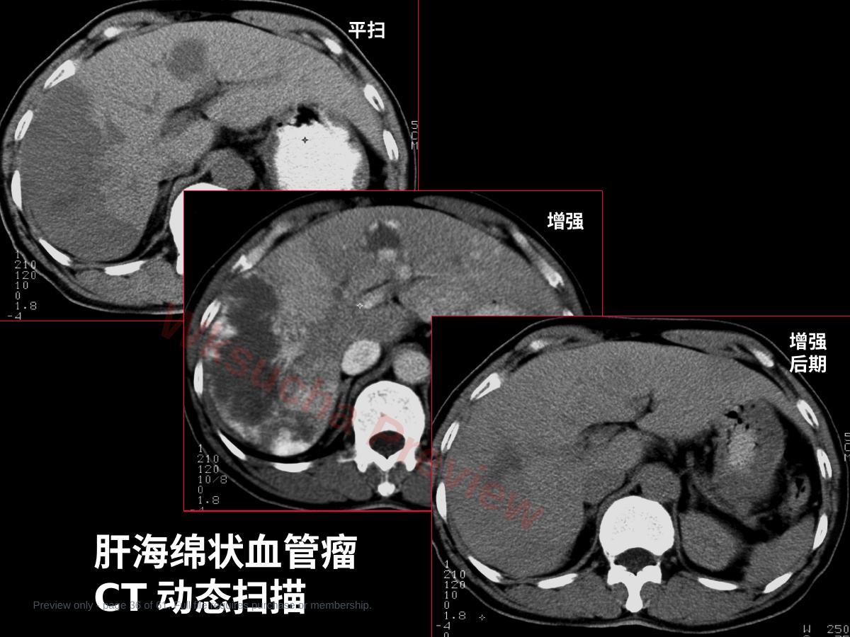 预览第 36 页
