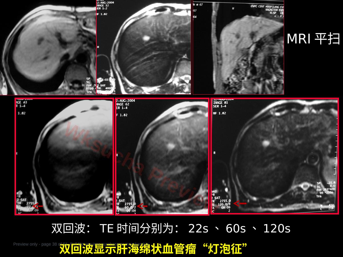 预览第 38 页