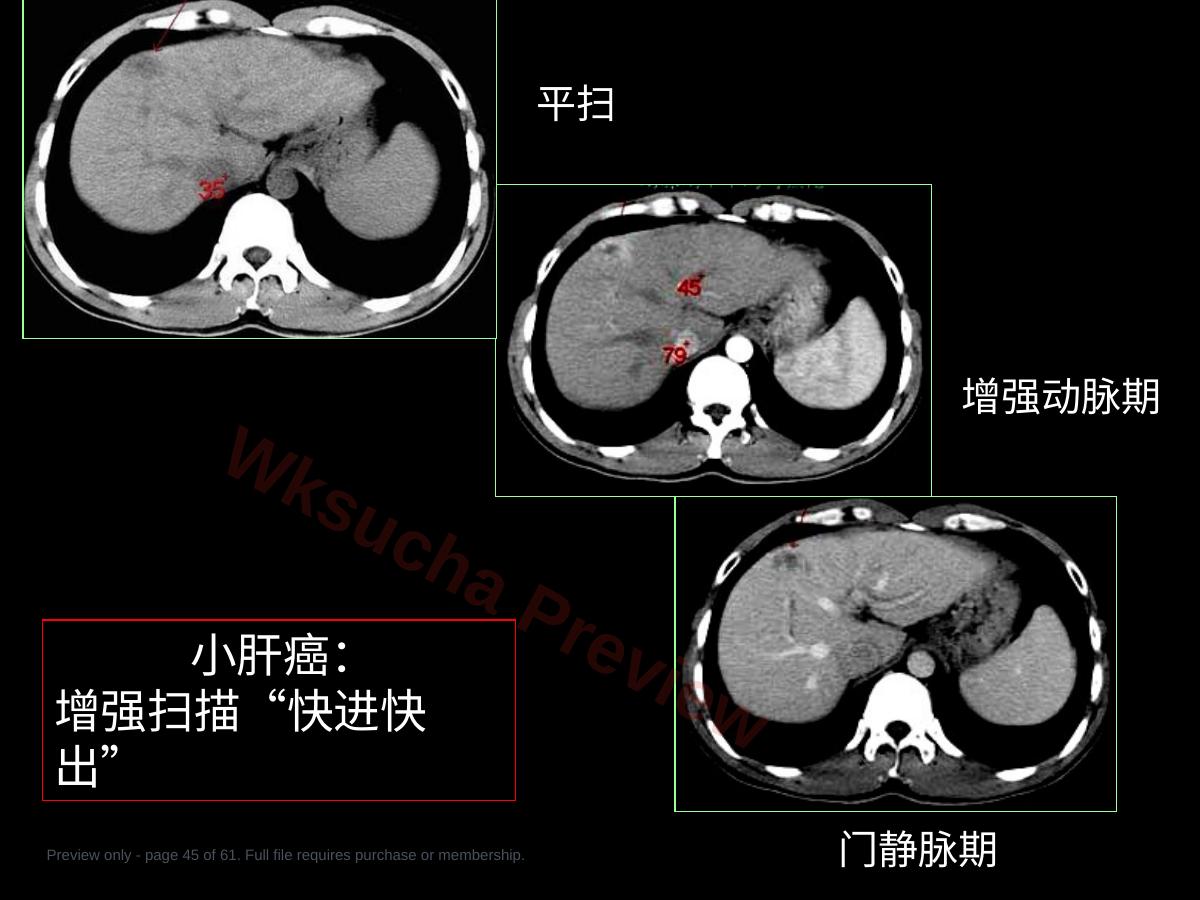 预览第 45 页