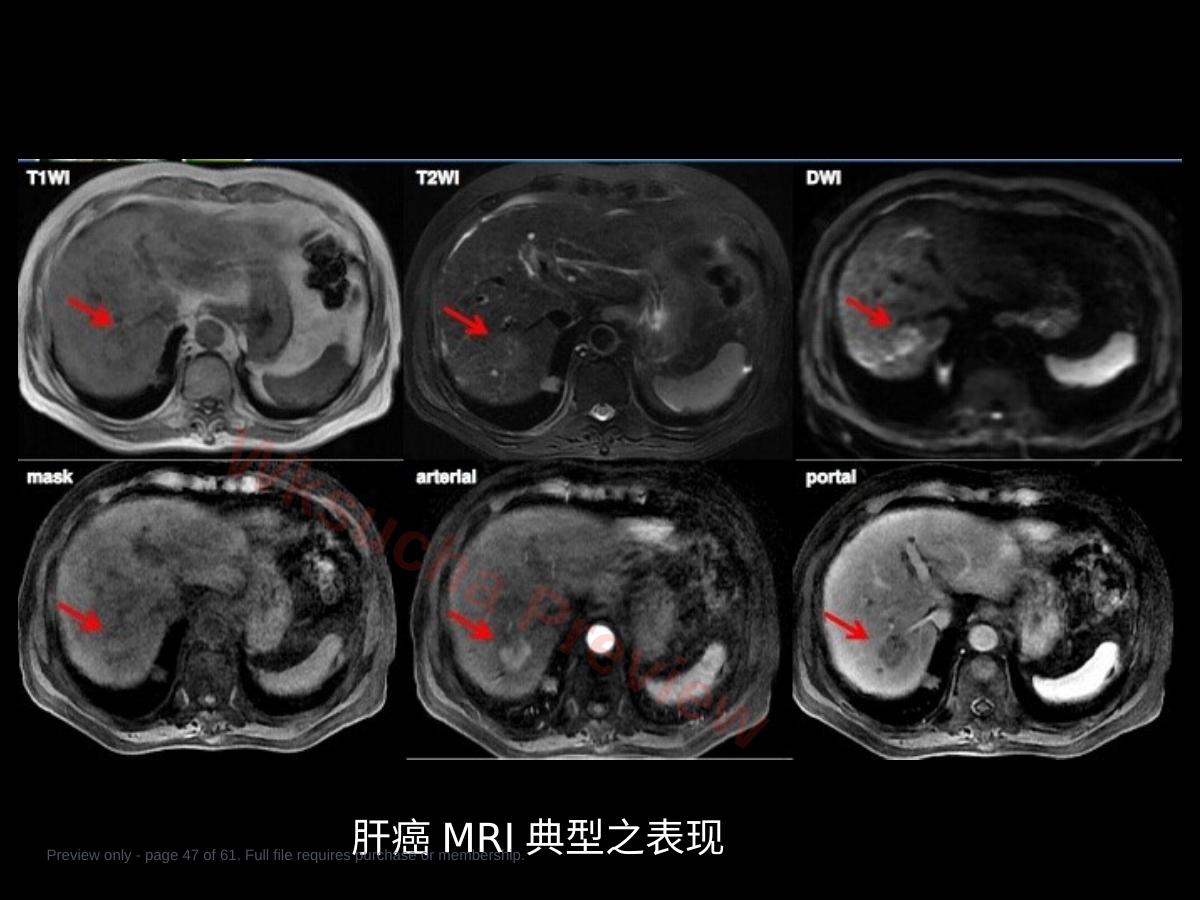 预览第 47 页