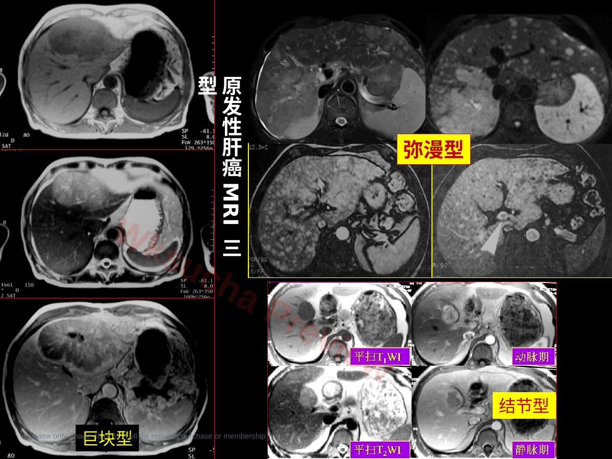 预览第 48 页