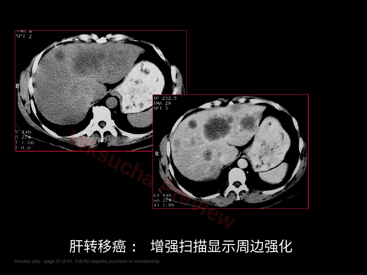 预览第 57 页