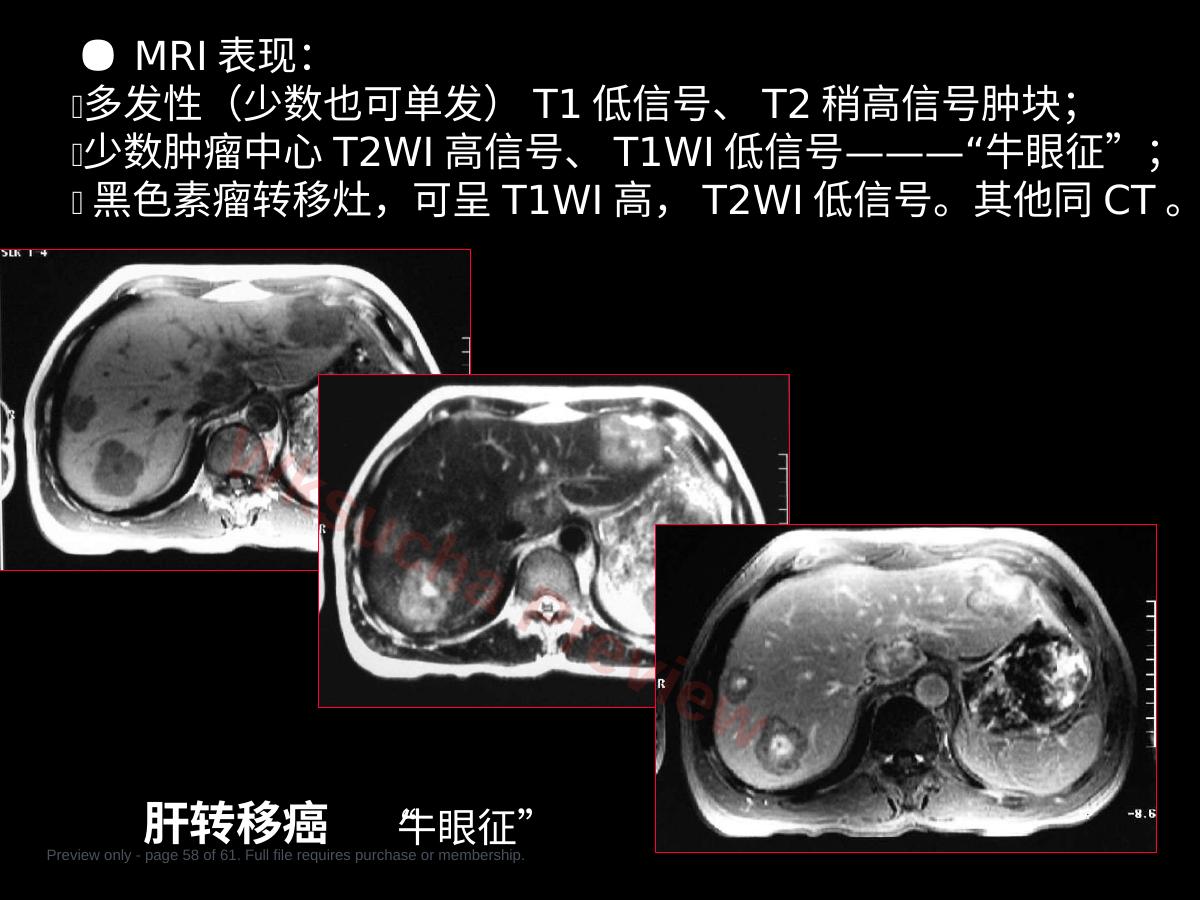 预览第 58 页