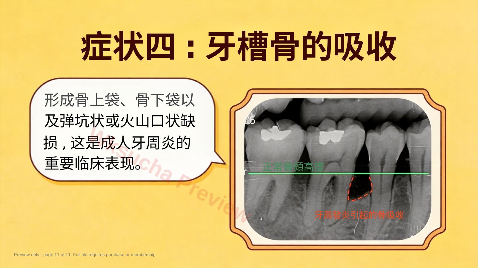 预览第 11 页