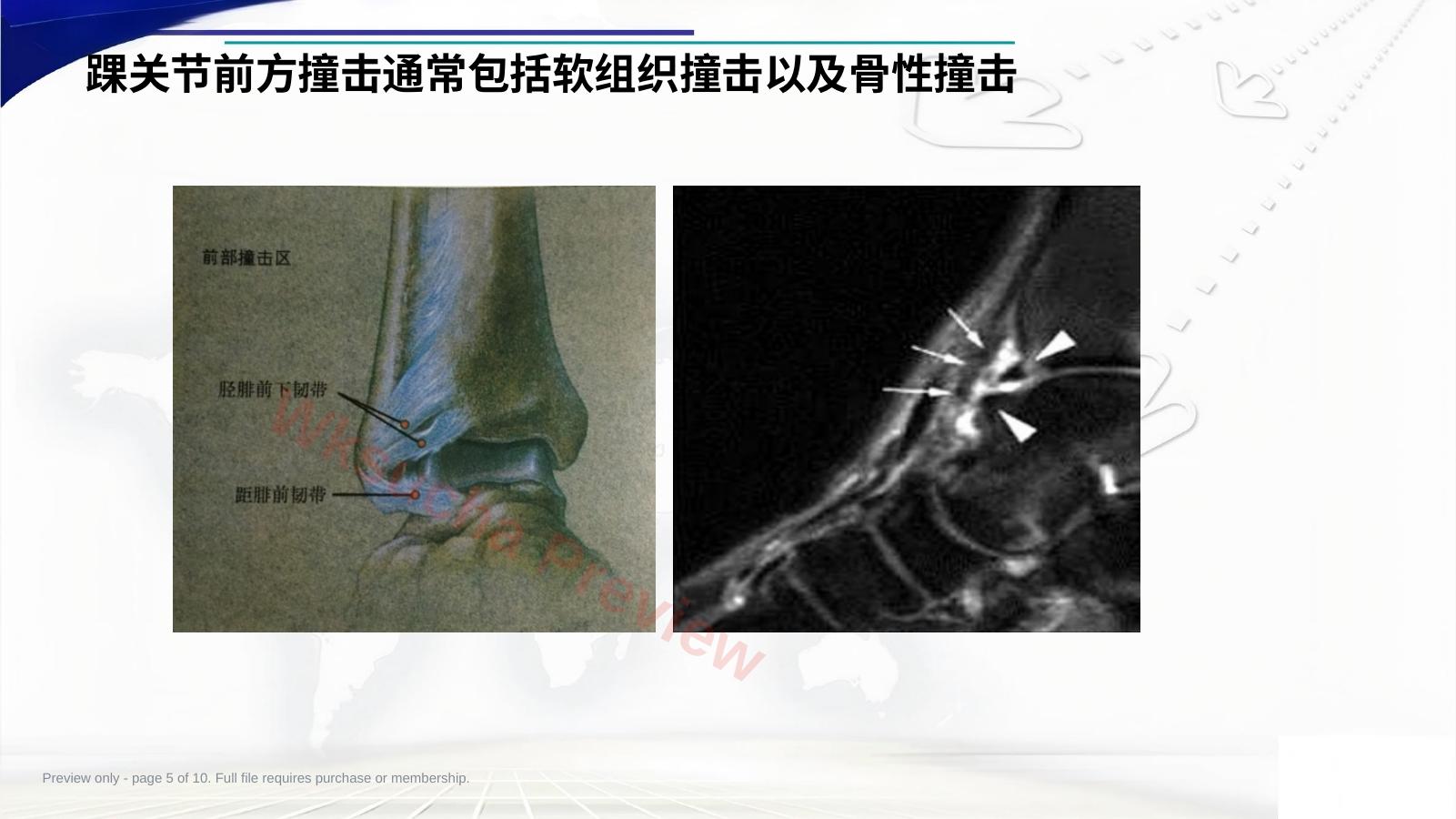 预览第 5 页