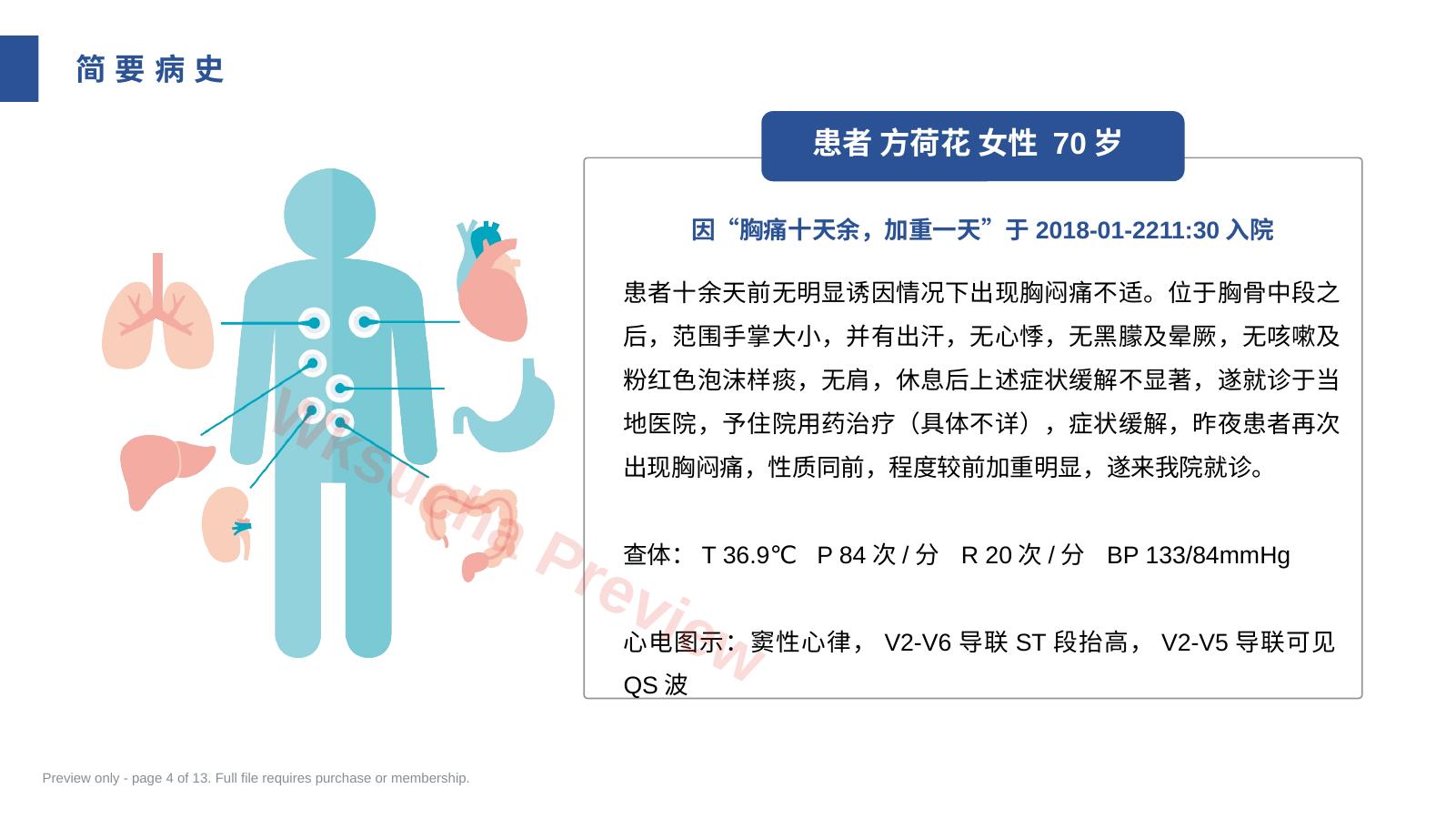 预览第 4 页