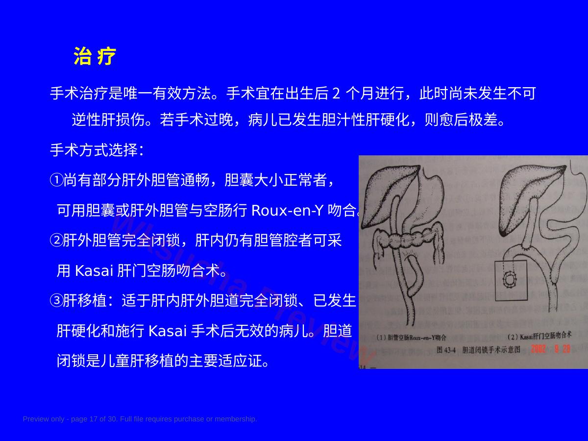 预览第 17 页