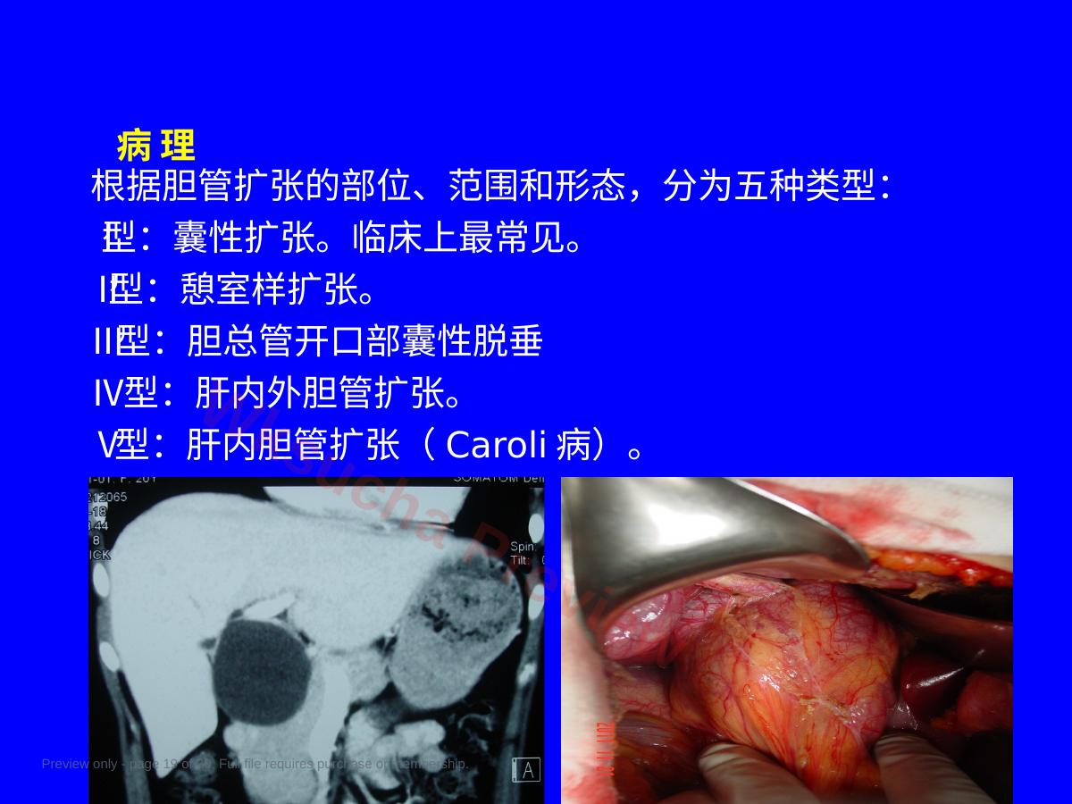 预览第 19 页