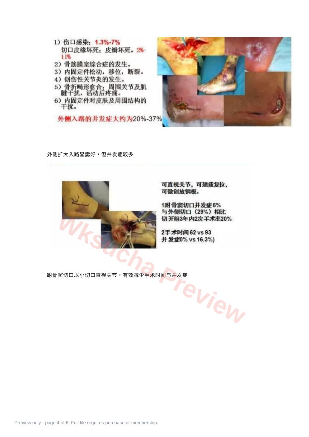 预览第 4 页