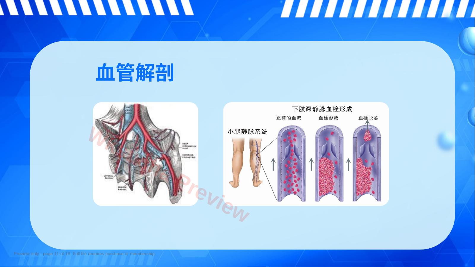 预览第 11 页