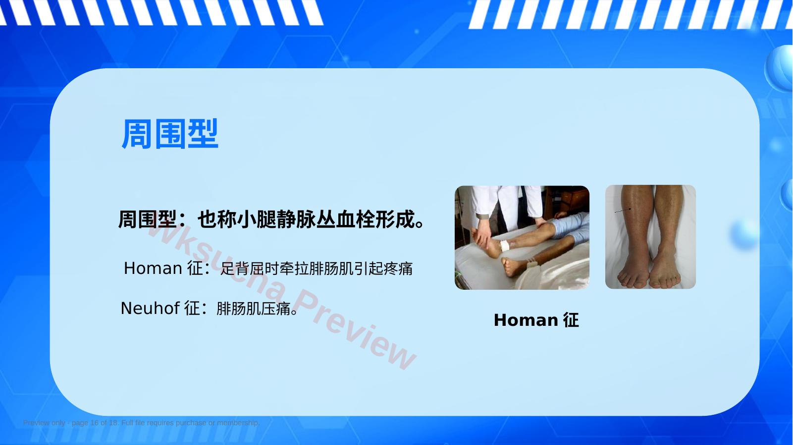 预览第 16 页